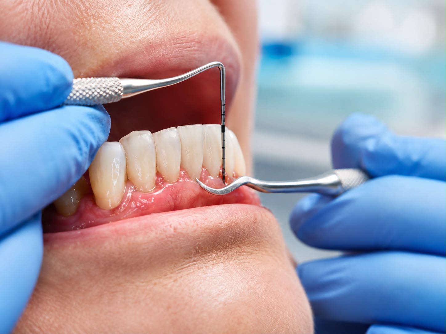Periodontics